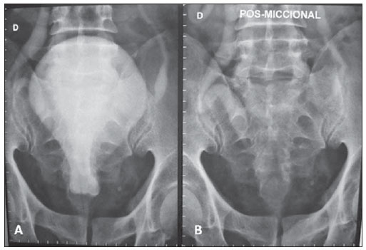 Radiologia Brasileira - Publicação oficial do Colégio Brasileiro